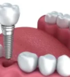 Neo Smile Dental Clinic