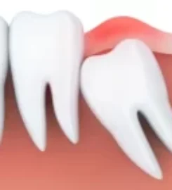 Neo Smile Dental Clinic