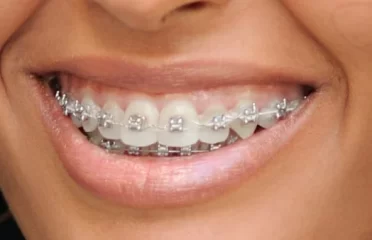 Neo Smile Dental Clinic