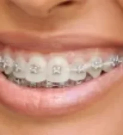 Neo Smile Dental Clinic