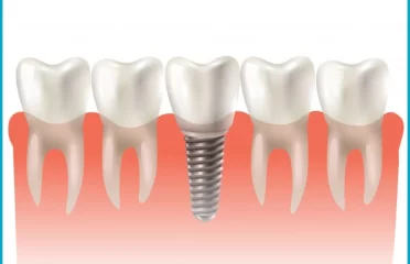 Neo Smile Dental Clinic