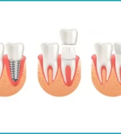 Neo Smile Dental Clinic