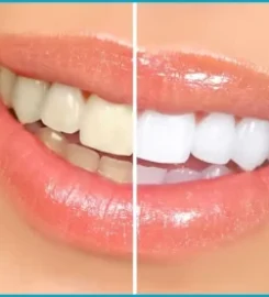 Neo Smile Dental Clinic