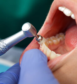 Neo Smile Dental Clinic