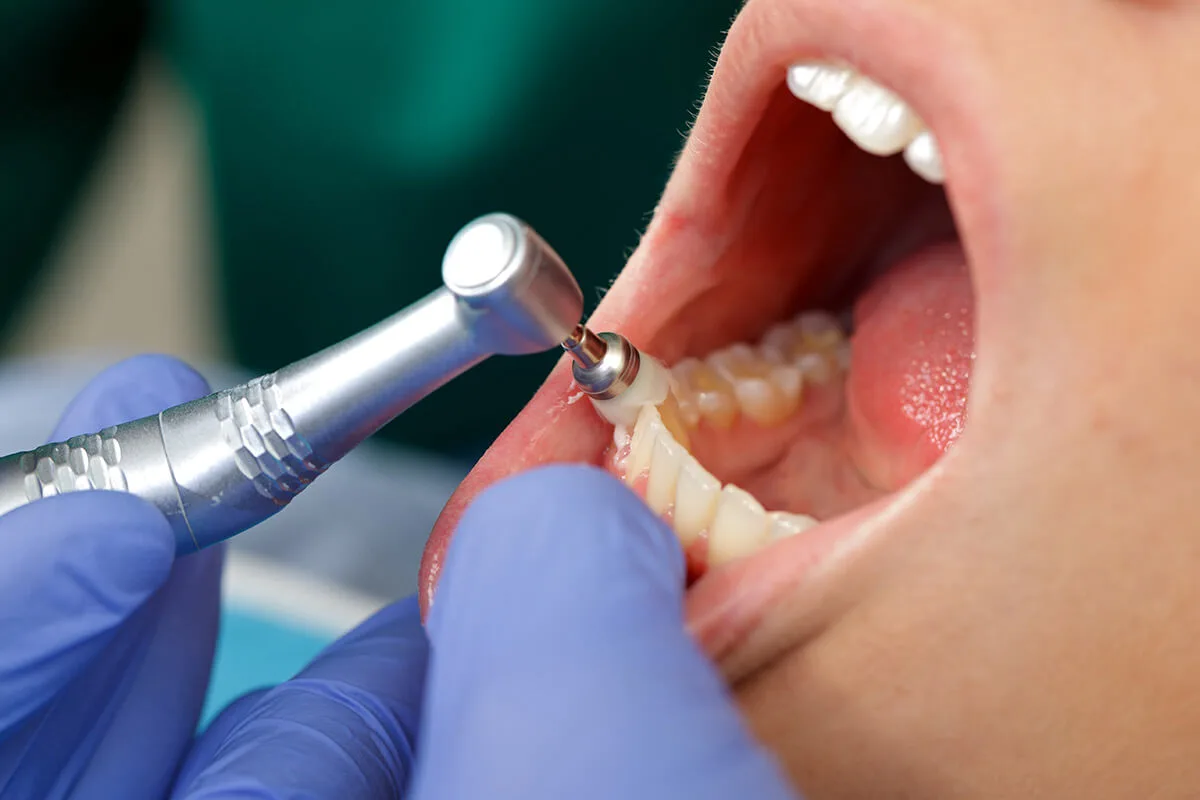Neo Smile Dental Clinic