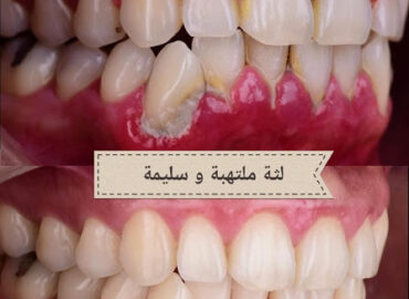 Acanutorammar Junaid